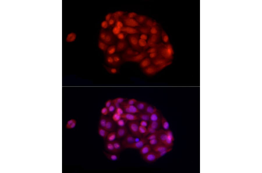 Immunofluorescence - Anti-ADAR1 Antibody (A15941) - Antibodies.com