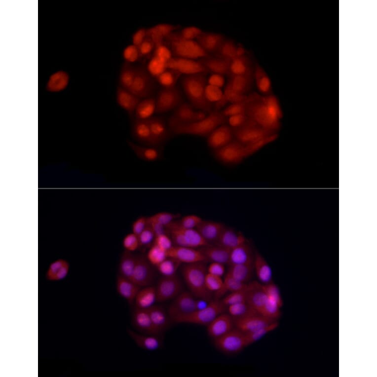 Immunofluorescence - Anti-ADAR1 Antibody (A15941) - Antibodies.com