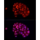 Immunofluorescence - Anti-ADAR1 Antibody (A15941) - Antibodies.com