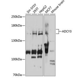 Western Blot - Anti-AC3 Antibody (A15942) - Antibodies.com