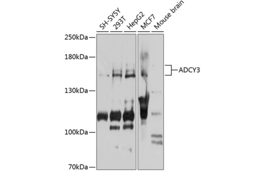 Western Blot - Anti-AC3 Antibody (A15942) - Antibodies.com