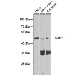 Western Blot - Anti-ADH7 Antibody (A15943) - Antibodies.com