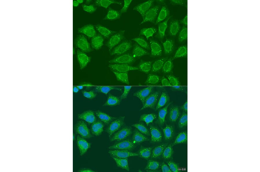 Immunofluorescence - Anti-ADH7 Antibody (A15943) - Antibodies.com