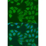 Immunofluorescence - Anti-ADH7 Antibody (A15943) - Antibodies.com