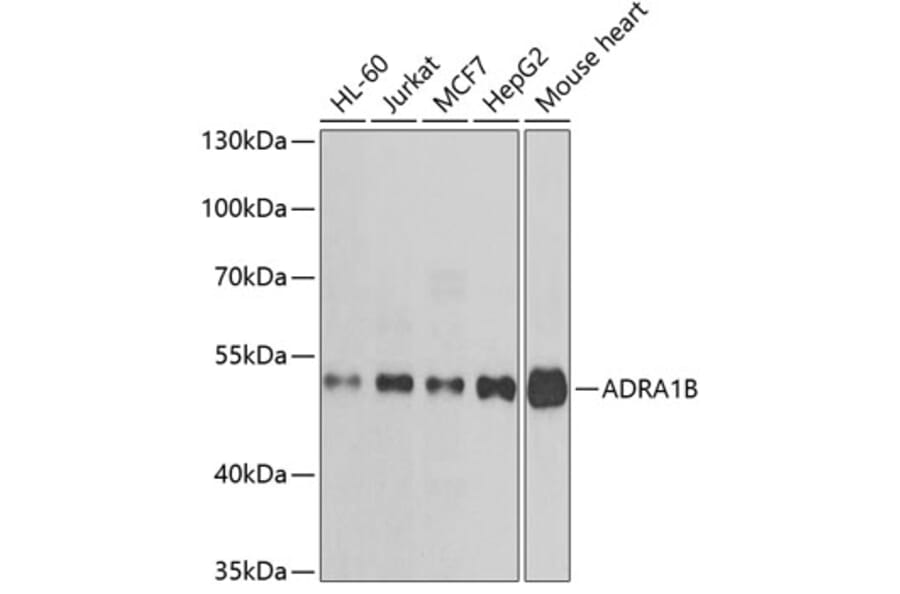 Western Blot - Anti-ADRA1B Antibody (A15944) - Antibodies.com