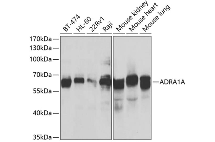 Western Blot - Anti-ADRA1A Antibody (A7873) - Antibodies.com