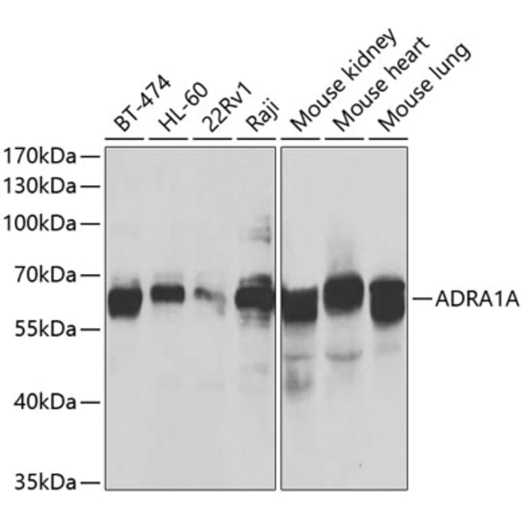 Western Blot - Anti-ADRA1A Antibody (A7873) - Antibodies.com