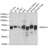 Western Blot - Anti-ADRA1A Antibody (A7873) - Antibodies.com