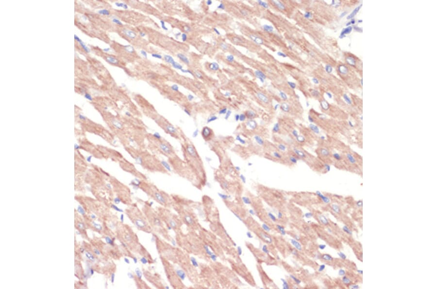Immunohistochemistry - Anti-ADRA1A Antibody (A7873) - Antibodies.com