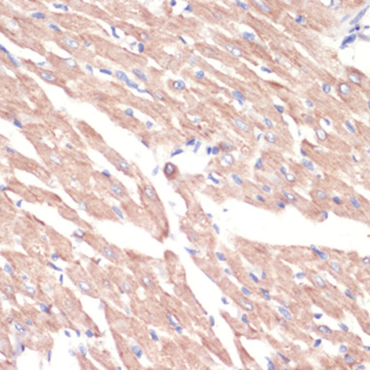 Immunohistochemistry - Anti-ADRA1A Antibody (A7873) - Antibodies.com