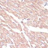 Immunohistochemistry - Anti-ADRA1A Antibody (A7873) - Antibodies.com