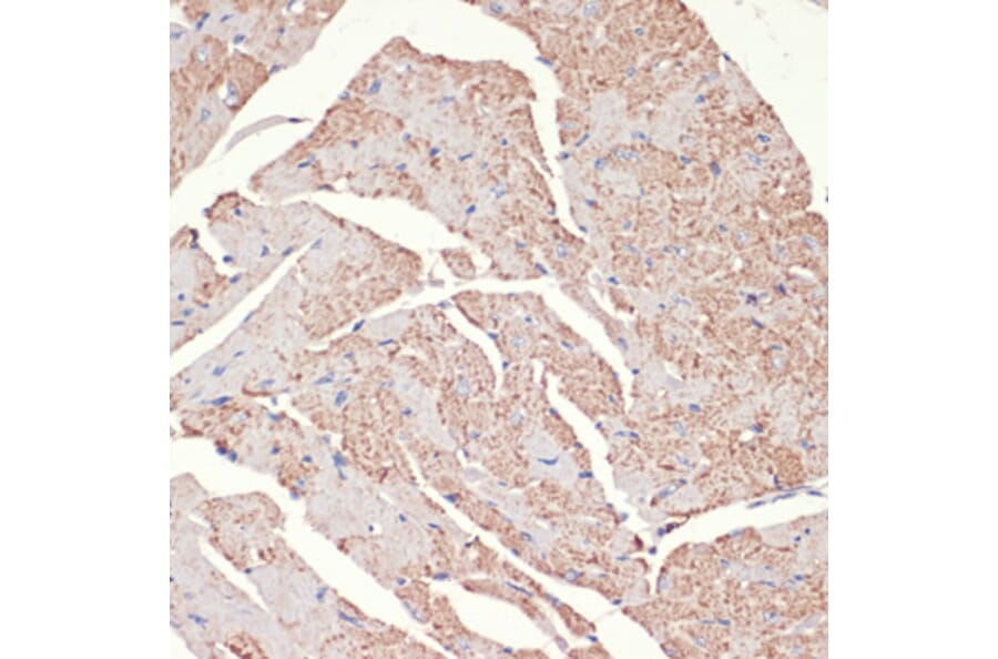 Immunohistochemistry - Anti-ADRA1A Antibody (A7873) - Antibodies.com