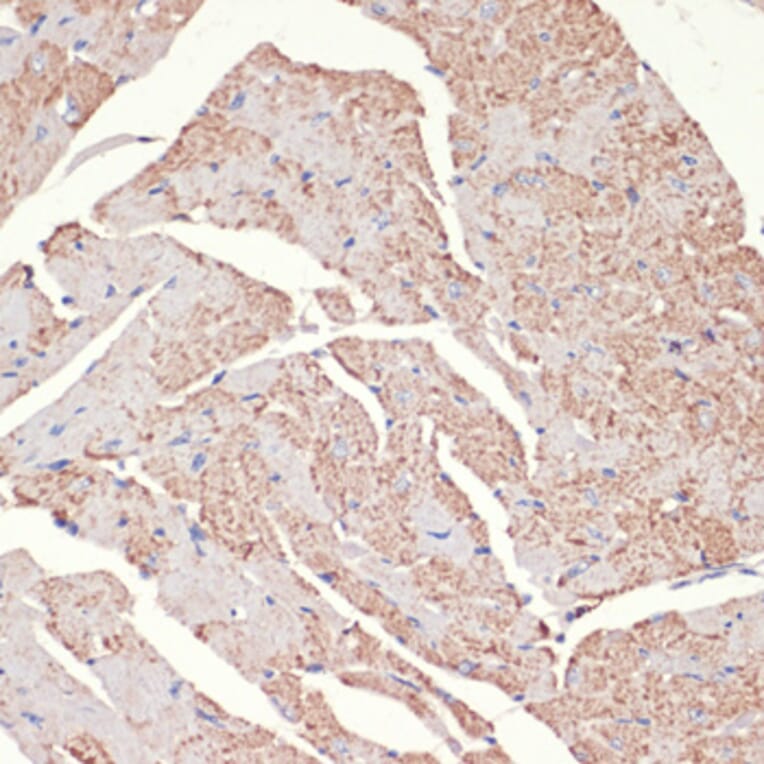 Immunohistochemistry - Anti-ADRA1A Antibody (A7873) - Antibodies.com