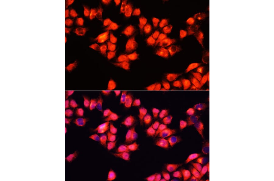 Immunofluorescence - Anti-ADRA1A Antibody (A7873) - Antibodies.com