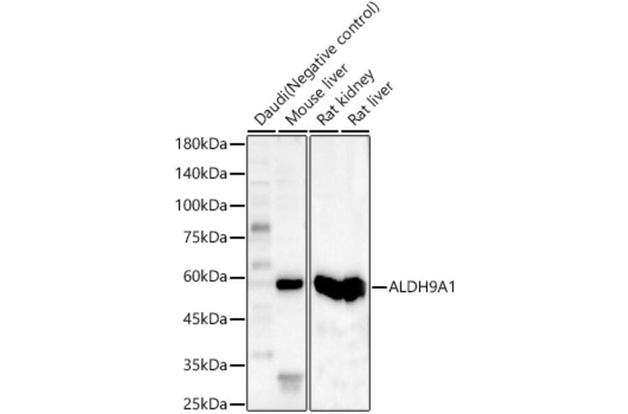 Western Blot - Anti-ALDH9A1 Antibody (A15947) - Antibodies.com