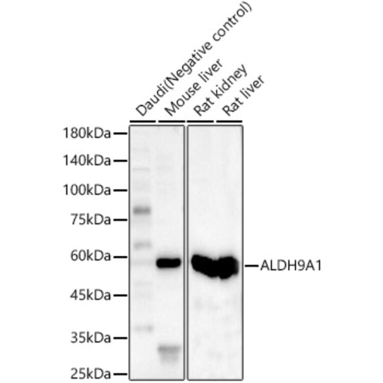 Western Blot - Anti-ALDH9A1 Antibody (A15947) - Antibodies.com
