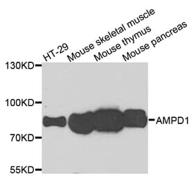 Western Blot - Anti-AMPD1 Antibody (A7876) - Antibodies.com