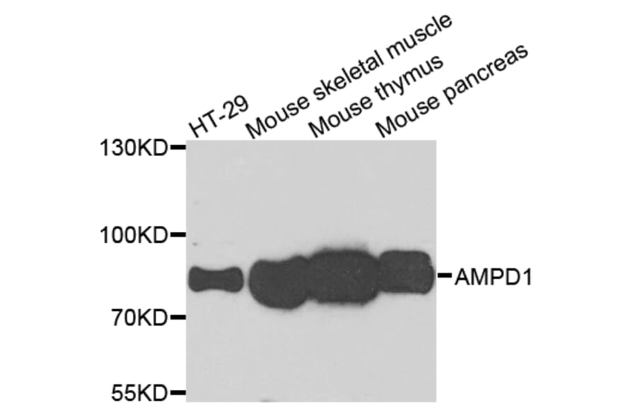 Western Blot - Anti-AMPD1 Antibody (A7876) - Antibodies.com