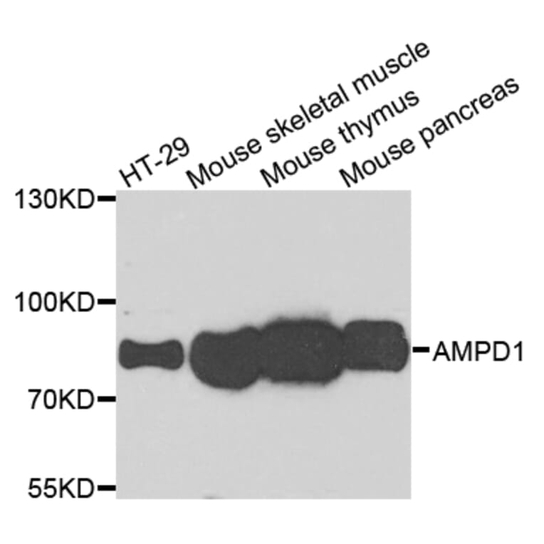Western Blot - Anti-AMPD1 Antibody (A7876) - Antibodies.com