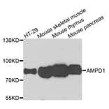 Western Blot - Anti-AMPD1 Antibody (A7876) - Antibodies.com