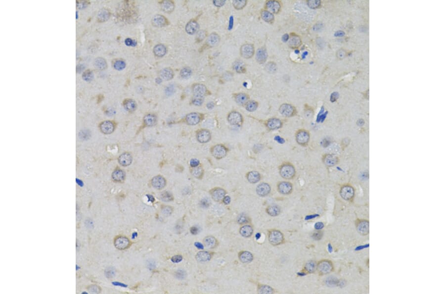 Immunohistochemistry - Anti-AMPD1 Antibody (A7876) - Antibodies.com