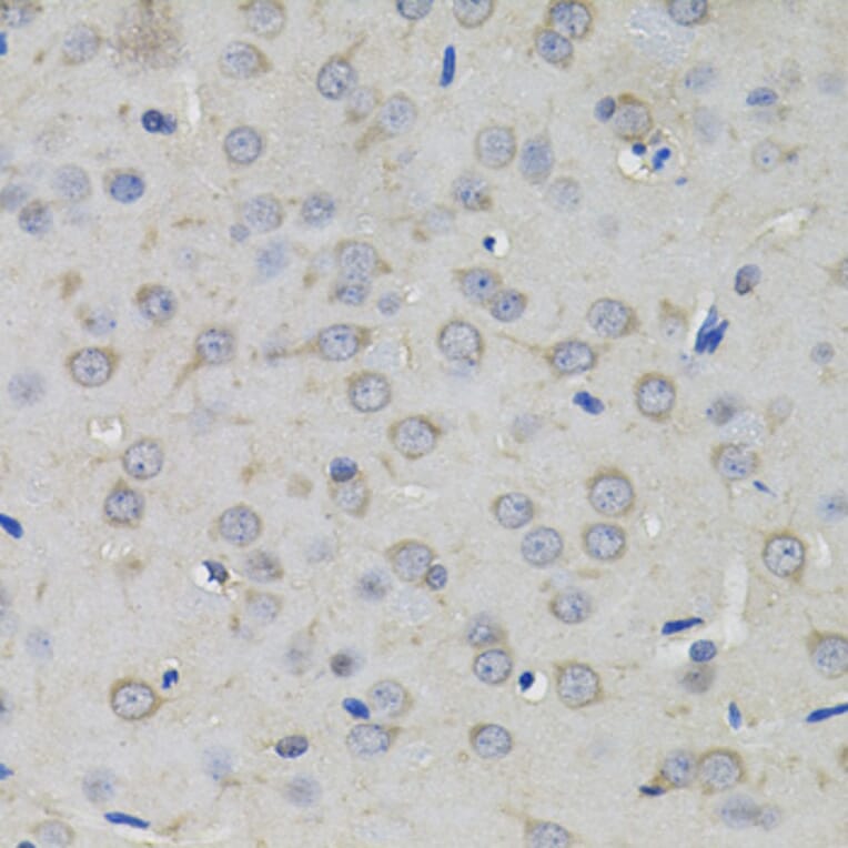 Immunohistochemistry - Anti-AMPD1 Antibody (A7876) - Antibodies.com