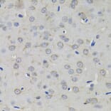 Immunohistochemistry - Anti-AMPD1 Antibody (A7876) - Antibodies.com