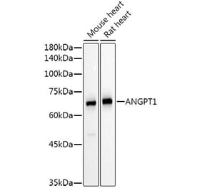 Western Blot - Anti-Angiopoietin 1 Antibody (A15949) - Antibodies.com