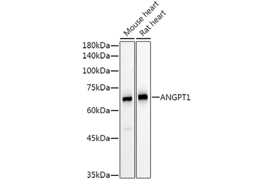 Western Blot - Anti-Angiopoietin 1 Antibody (A15949) - Antibodies.com