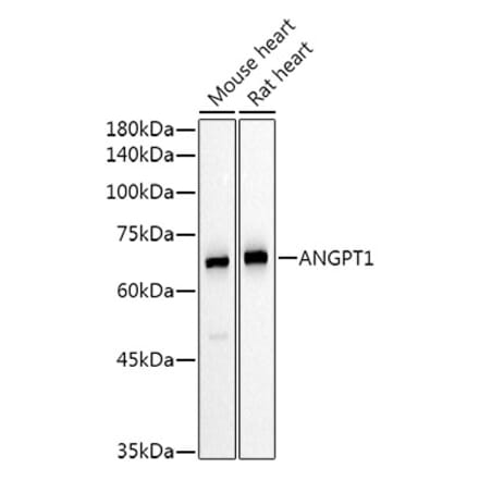 Western Blot - Anti-Angiopoietin 1 Antibody (A15949) - Antibodies.com