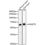 Western Blot - Anti-Angiopoietin 1 Antibody (A15949) - Antibodies.com