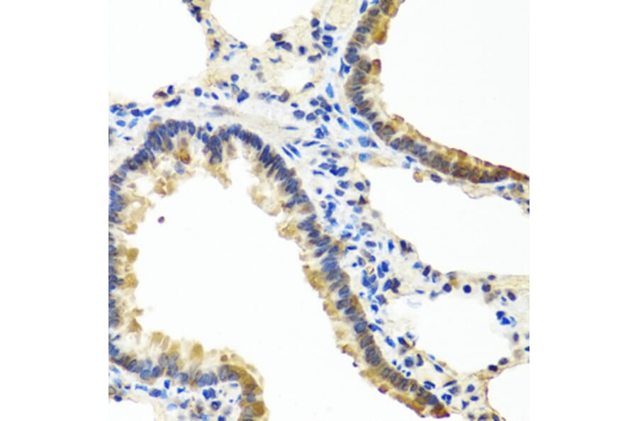 Immunohistochemistry - Anti-Angiopoietin 1 Antibody (A15949) - Antibodies.com