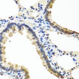 Immunohistochemistry - Anti-Angiopoietin 1 Antibody (A15949) - Antibodies.com