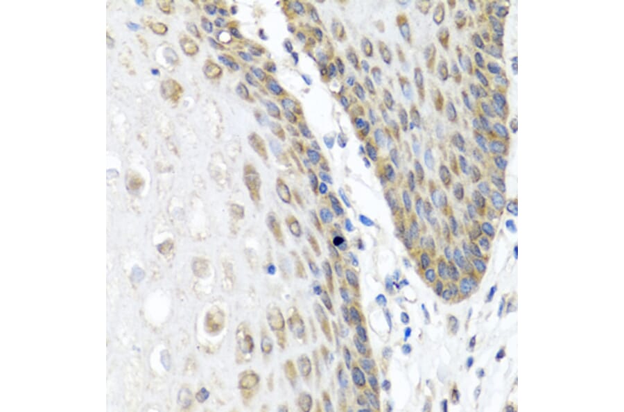 Immunohistochemistry - Anti-Angiopoietin 1 Antibody (A15949) - Antibodies.com