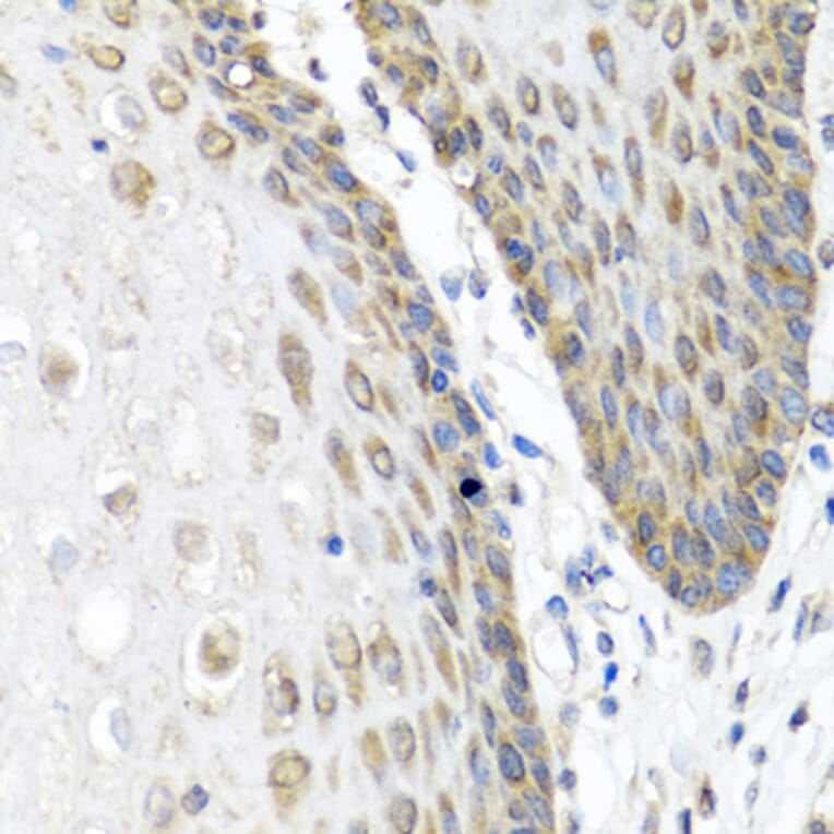 Immunohistochemistry - Anti-Angiopoietin 1 Antibody (A15949) - Antibodies.com