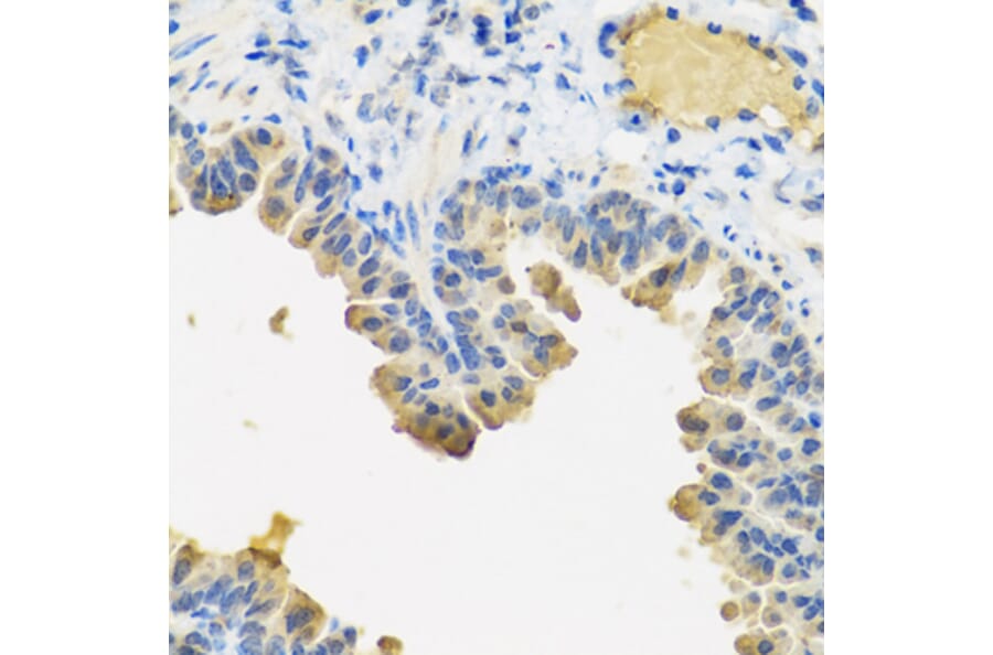 Immunohistochemistry - Anti-Angiopoietin 1 Antibody (A15949) - Antibodies.com