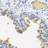 Immunohistochemistry - Anti-Angiopoietin 1 Antibody (A15949) - Antibodies.com