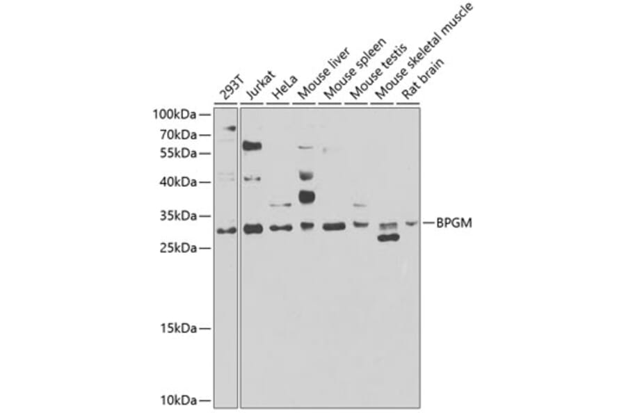 Western Blot - Anti-BPGM Antibody (A15950) - Antibodies.com