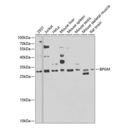 Western Blot - Anti-BPGM Antibody (A15950) - Antibodies.com