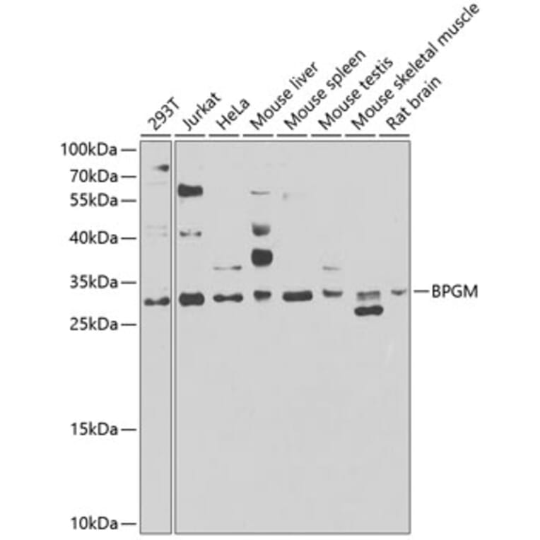 Western Blot - Anti-BPGM Antibody (A15950) - Antibodies.com