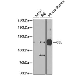 Western Blot - Anti-CBL Antibody (A15951) - Antibodies.com