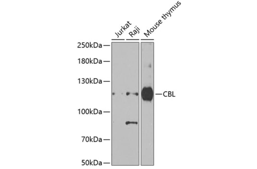 Western Blot - Anti-CBL Antibody (A15951) - Antibodies.com