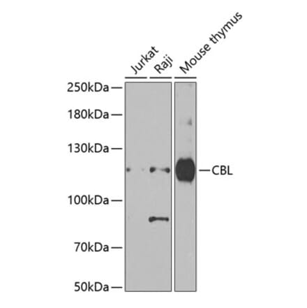 Western Blot - Anti-CBL Antibody (A15951) - Antibodies.com