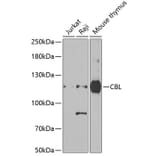 Western Blot - Anti-CBL Antibody (A15951) - Antibodies.com