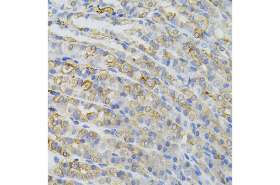 Immunohistochemistry - Anti-CBL Antibody (A15951) - Antibodies.com