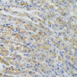 Immunohistochemistry - Anti-CBL Antibody (A15951) - Antibodies.com