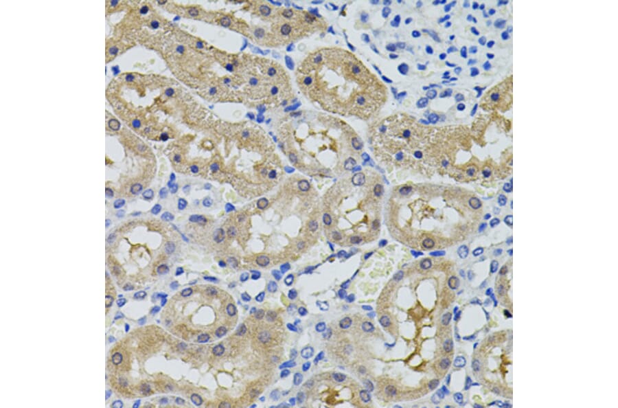 Immunohistochemistry - Anti-CBL Antibody (A15951) - Antibodies.com