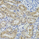 Immunohistochemistry - Anti-CBL Antibody (A15951) - Antibodies.com