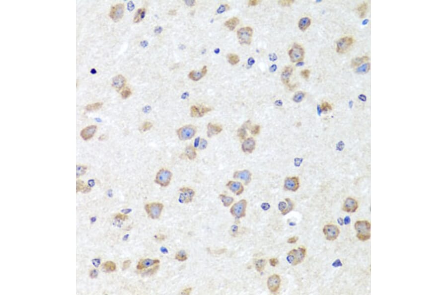 Immunohistochemistry - Anti-Chd1 Antibody (A15952) - Antibodies.com