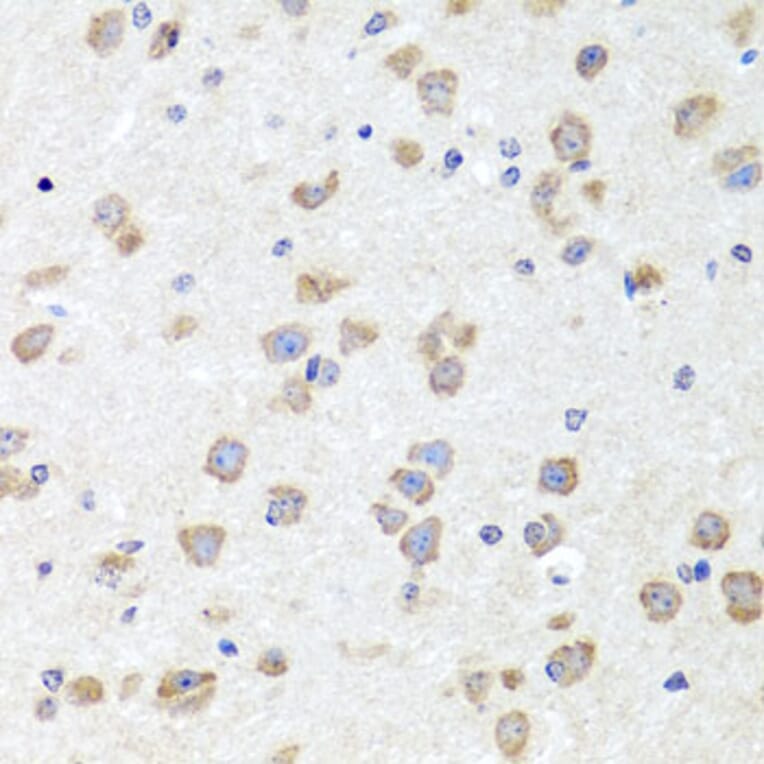 Immunohistochemistry - Anti-Chd1 Antibody (A15952) - Antibodies.com